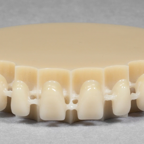 Couronne implantaire provisoire